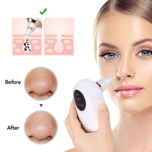 Portable Deep Pore Cleaner & Blackhead Remover