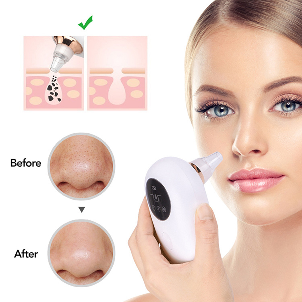 Portable Deep Pore Cleaner & Blackhead Remover